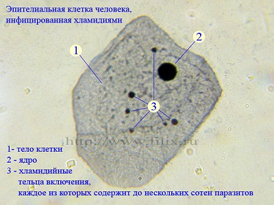 Эпителиальная клетка человека, инфицированная хламидиями