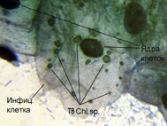 Chlamydia; autor: V.Dvoryanchikov, http://www.filix.ru