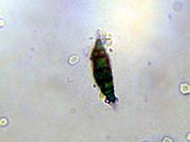 Microsporum canis; autor: V.Dvoryanchikov, http://www.filix.ru